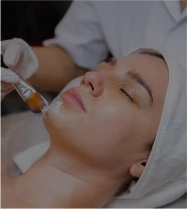 Chemical Peel In Naperville
