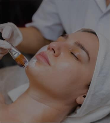 Chemical Peels In Naperville