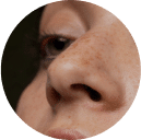 Reduce Enlarged Pores With Microneedling
